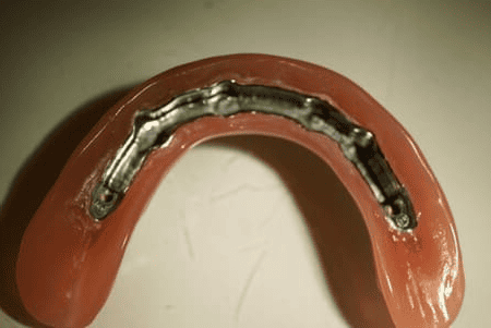 Zubna protetika Crnojević Dental Studio